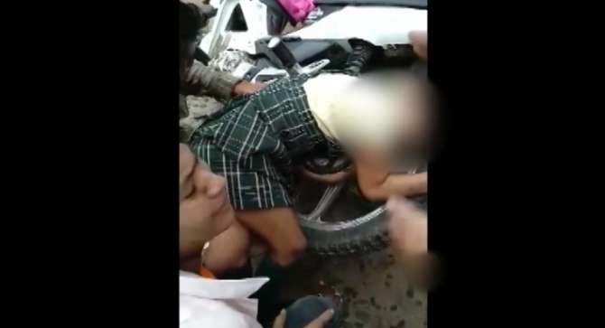  Escolar se fractura el brazo tras quedar atrapado entre la llanta de una motocicleta