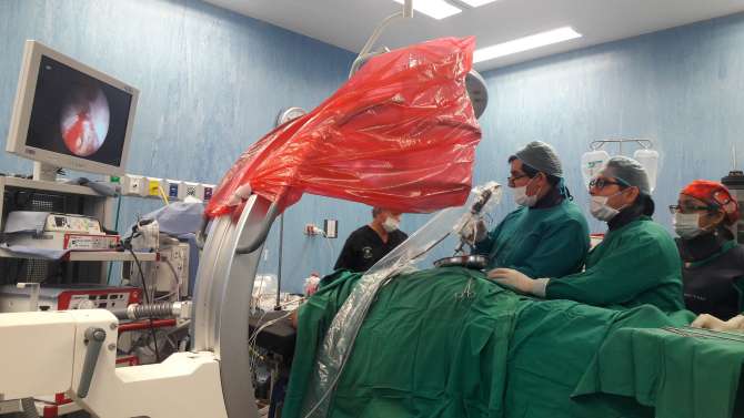  Implementan nuevas técnicas para extraer cálculos de riñón en Hospital de Tarapoto